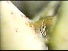 Thumb 11